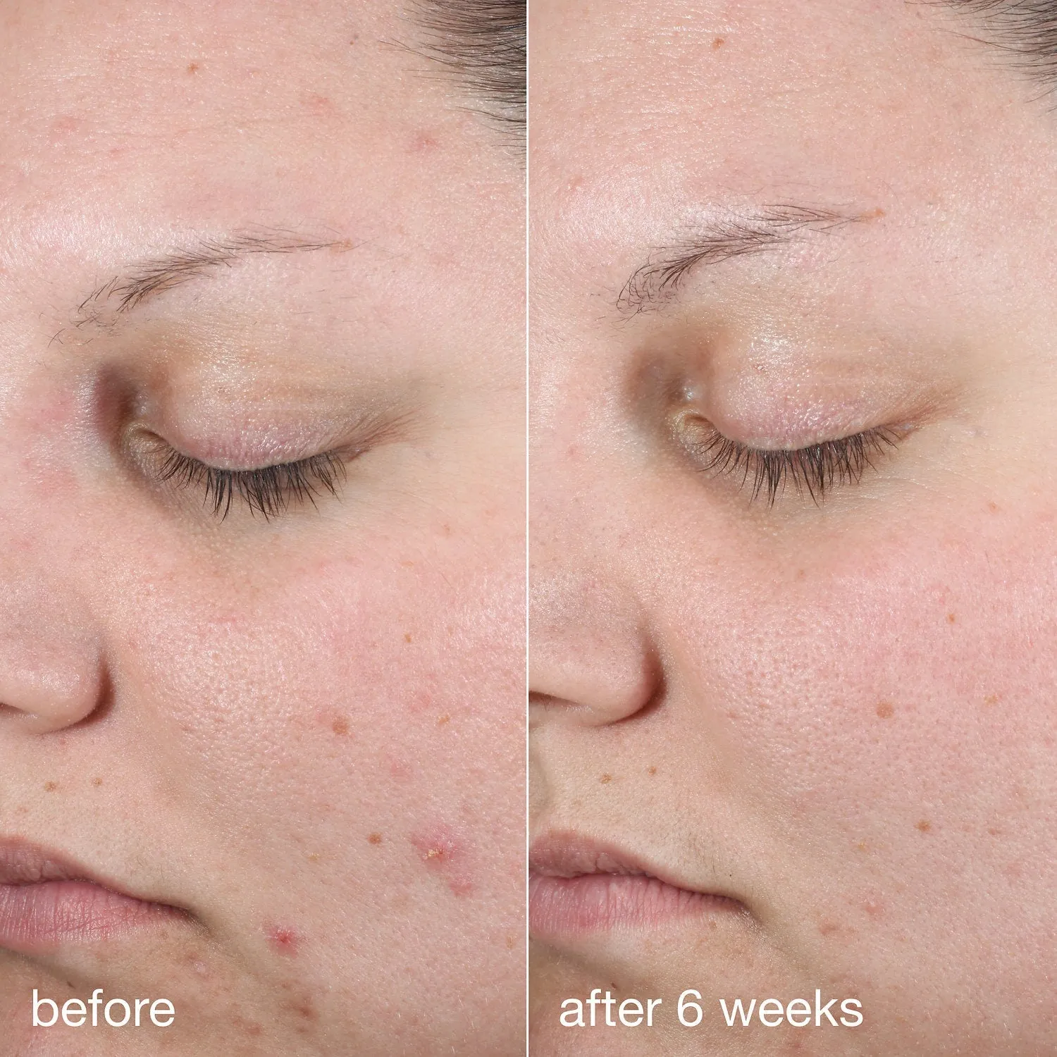 Dermalogica Active Clearing Age Bright Clearing Serum